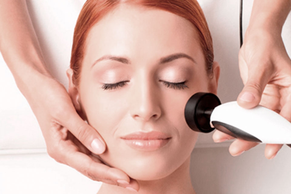 Tratamiento de microneedling (Dermapen)
